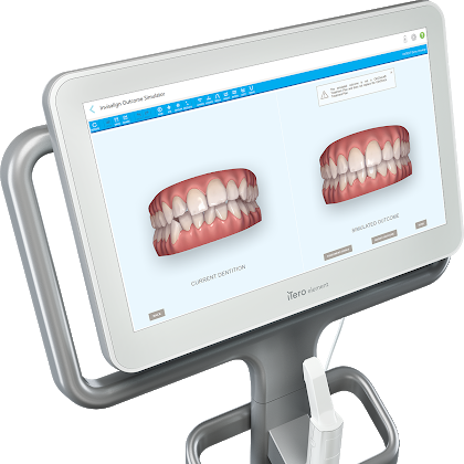 長野市のマウスピース矯正 インビザライン 専門サイト